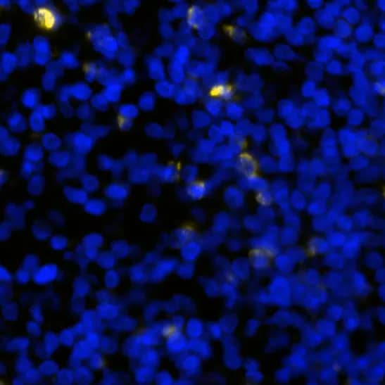 LAG-3 was detected in immersion fixed paraffin-embedded sections of human tonsil using Mouse Anti-Human LAG-3 Monoclonal Antibody (NOVUS Catalog # NBP2-80059) at 1:150 at 37 ° Celsius for 4 minutes. Before incubation with the primary antibody, tissue underwent an all-in-one dewaxing and antigen retrieval preprocessing using PreTreatment Module (PT Module) and Dewax and HIER Buffer H (pH 9). Tissue was stained using the Alexa Fluor™ 647 Goat anti-Mouse IgG Secondary Antibody at 1:200 at 37 ° Celsius for 2 minutes. (Yellow; Lunaphore Catalog # DR647MS) and counterstained with DAPI (blue; Lunaphore Catalog # DR100). Specific staining was localized to the membrane and cytoplasm. Protocol available in COMET™ Panel Builder.